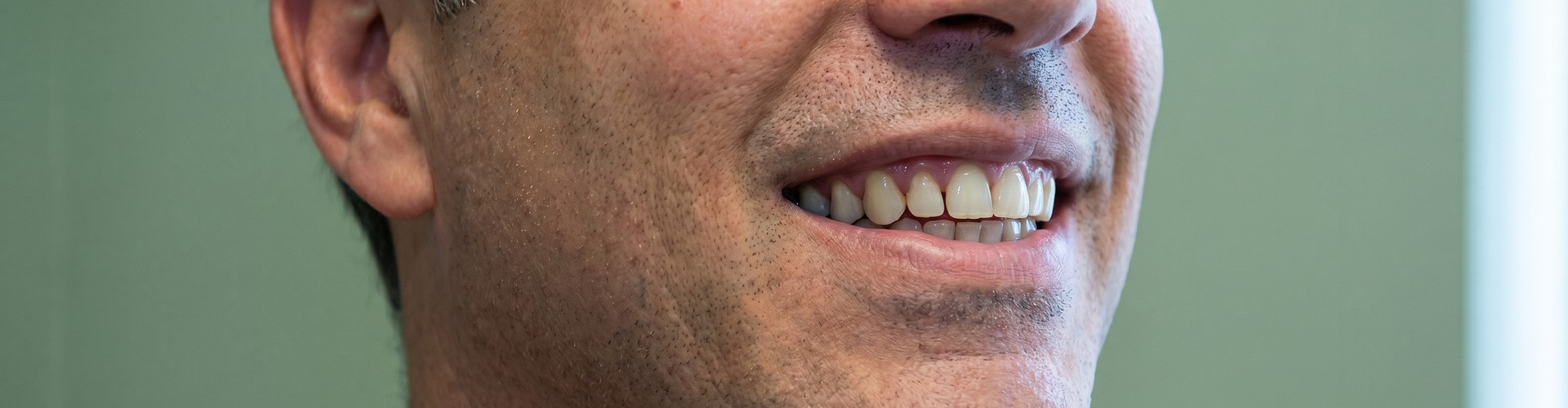 Close photo of man's smile.